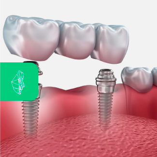 Centro Maxilofacial Talca Tratamientos Comunicaciones Cirugia Peri
