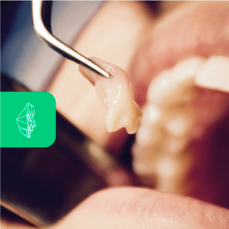 Centro-Maxilofacial-Talca-Tratamientos-Extracción-Dientes