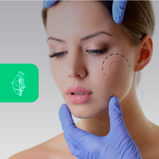 Centro Maxilofacial Talca Tratamientos Bichectomia